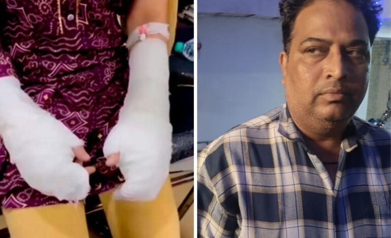  DU छात्रा पर एसिड अटैक का झूठा ड्रामा: पिता ने खुद रची साजिश, तीन युवकों को फंसाने की थी योजना